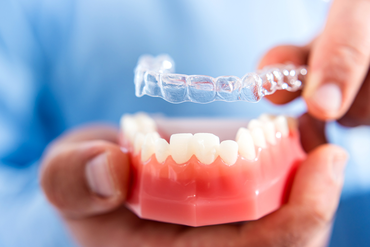 Top 10 Benefits of Invisalign Treatment for a Perfect Smile